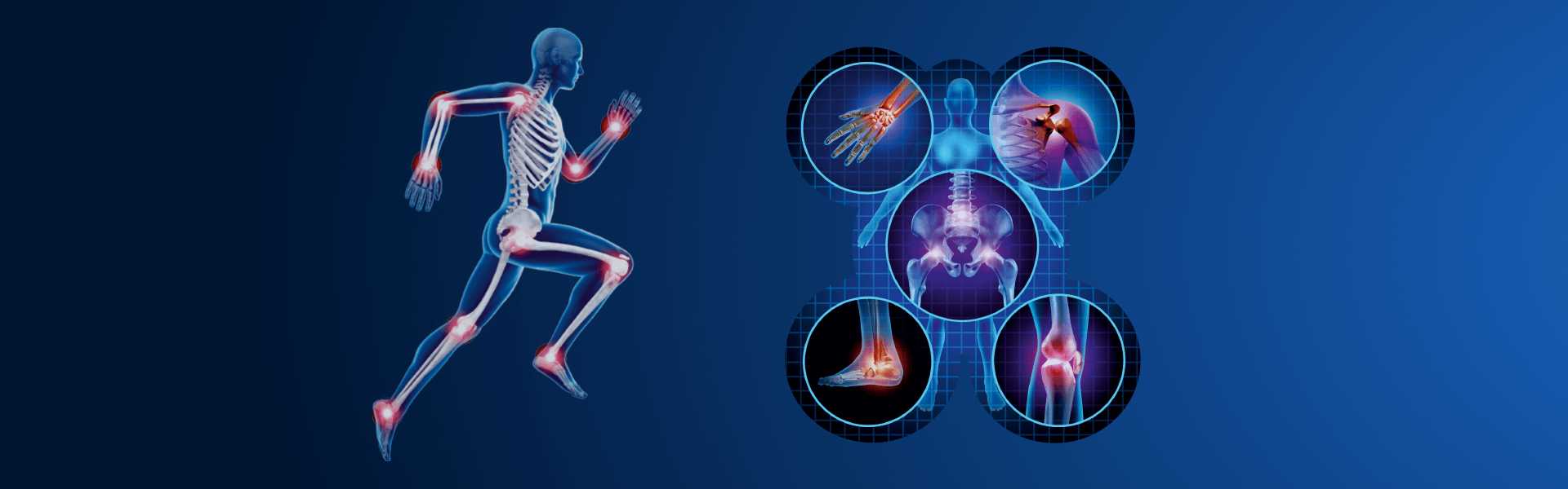 Bone Scan Imaging in Goa