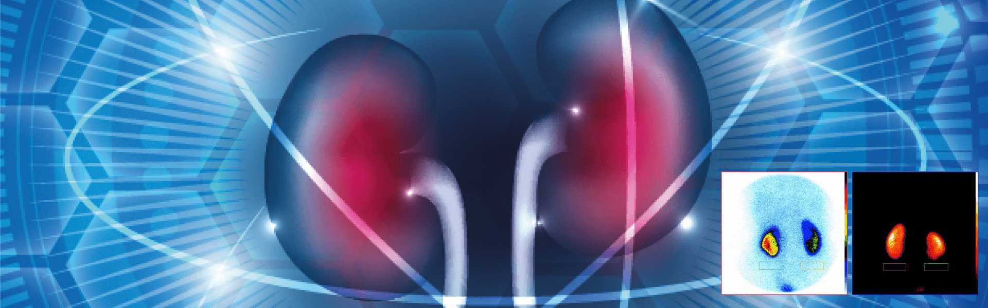 Renal Scan- DMSA in Goa Renal Scan in Goa