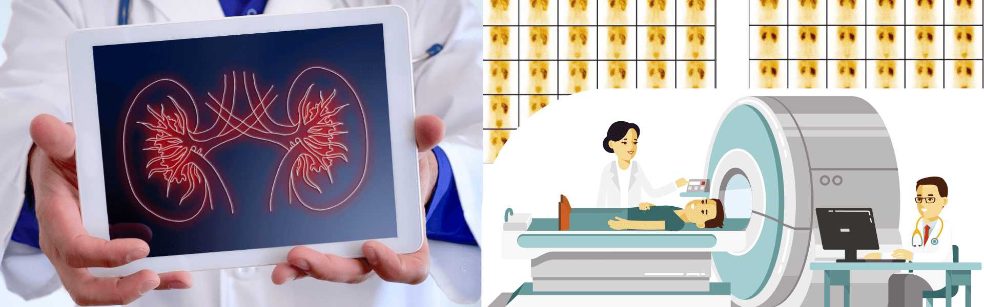 Best Renal Scan-DTPA & EC-Instructions in Goa