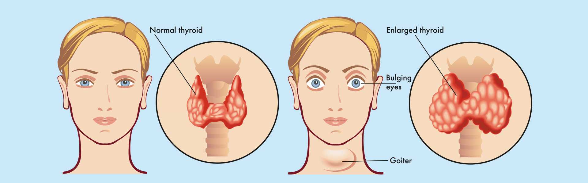 Thyroid Scan in Goa Thyroid Imaging in Goa