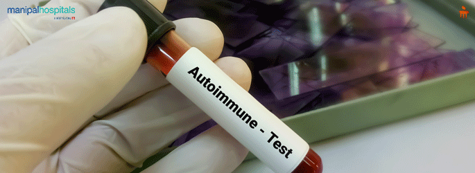 Autoimmune Diseases Treatment in Sarjapur Road