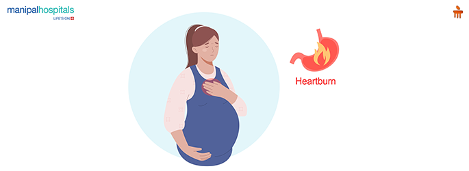 heartburn during pregnancy