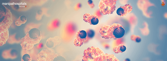 Best Hospital for HIPEC Surgery in Delhi