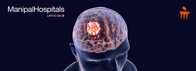 Neurology Hospital In Delhi