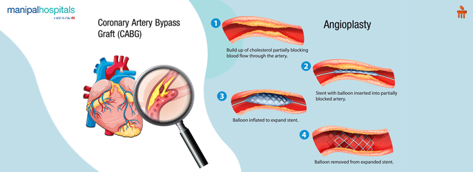 Cardiology hospital in Goa