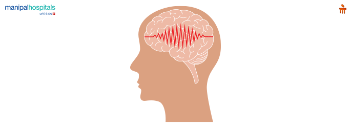 Epilepsy Treatment in Pregnancy