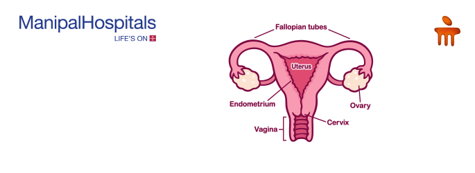 gynecologist in Delhi