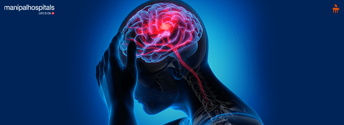 Best Neurology Hospital in Bangalore