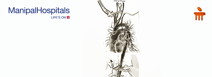 best heart specialist in Delhi