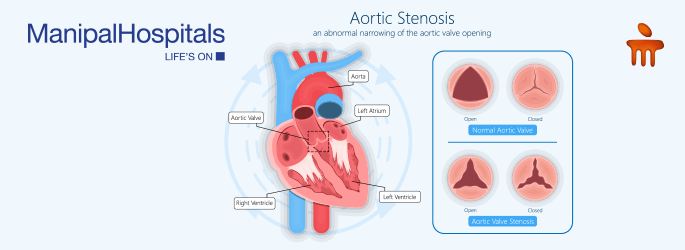 best heart hospital in Dwarka, Delhi
