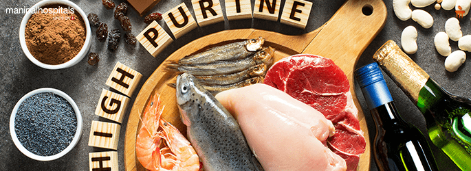 High Uric Acid Level Treatment in Varthur Road Bangalore 