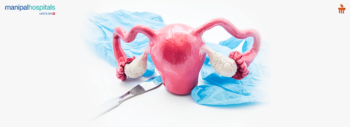 Hysterectomy in Gurugram 