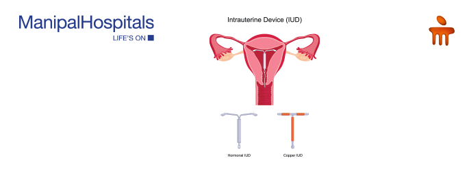 Best obstetrics and gynaecology hospital in Delhi