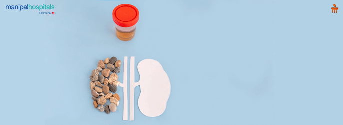 Kidney Stone and its management