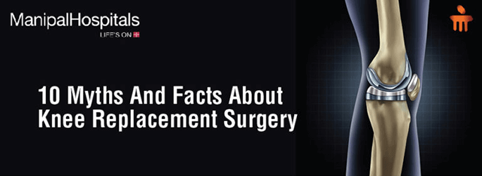 Myths And Facts About Knee Replacement