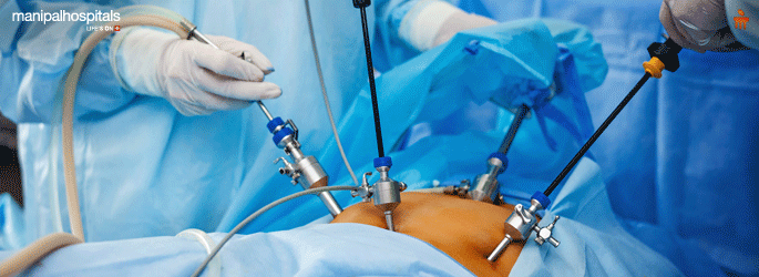 Laparoscopic Surgery in Sarjapur Bangalore