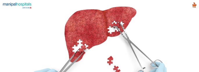 Liver diseases treatment in Vijayawada