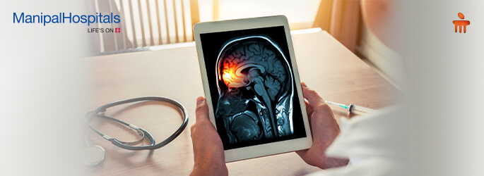 neurology hospital in Bangalore