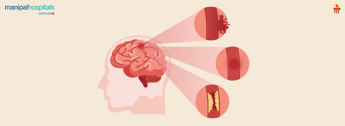 Best Neurology Hospital in Vijayawada