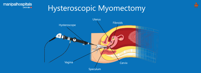 Gynaecology hospital in Sarjapur road Bangalore