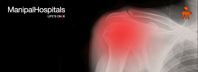 orthopedic doctor in Delhi