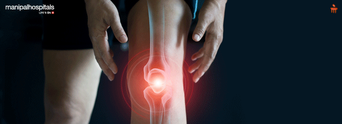 Knee Joint Replacement in Ghaziabad