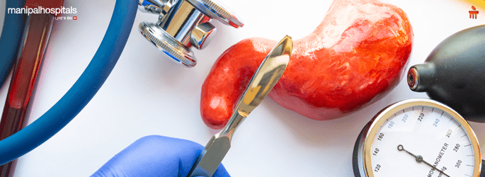 PCOD Treatment in Millers Road Bangalore