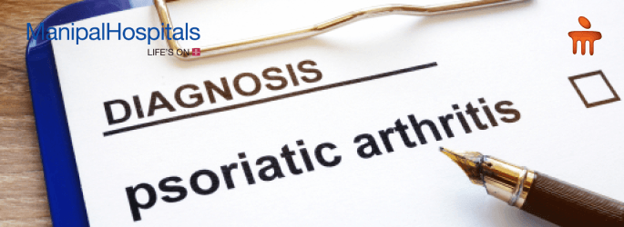 Arthritis Treatment in Bangalore