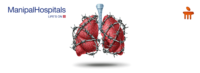 Lung malignancies/cancer treatment in Vijayawada