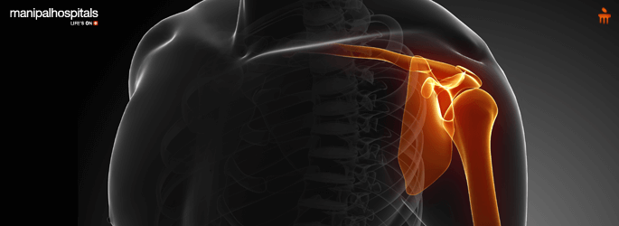 Shoulder Dislocation Treatment in Baner Pune