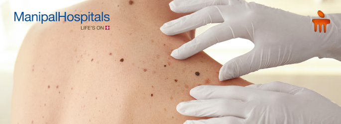 best skincare hospital in Mangalore