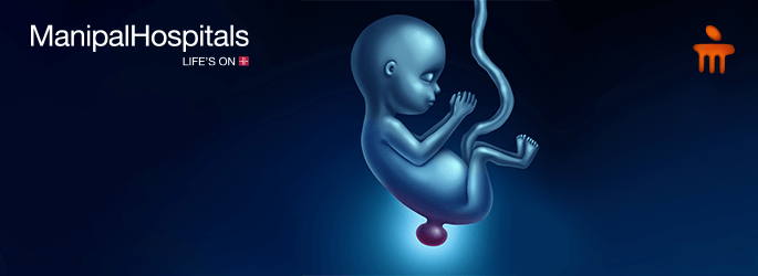 neurology hospital in Delhi