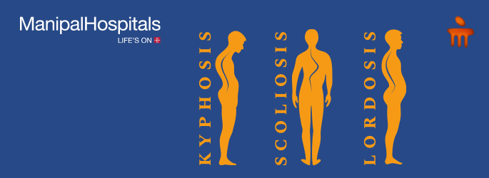 best spine hospital in Bangalore