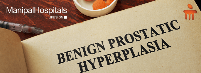 Top best urology hospital in Dwarka