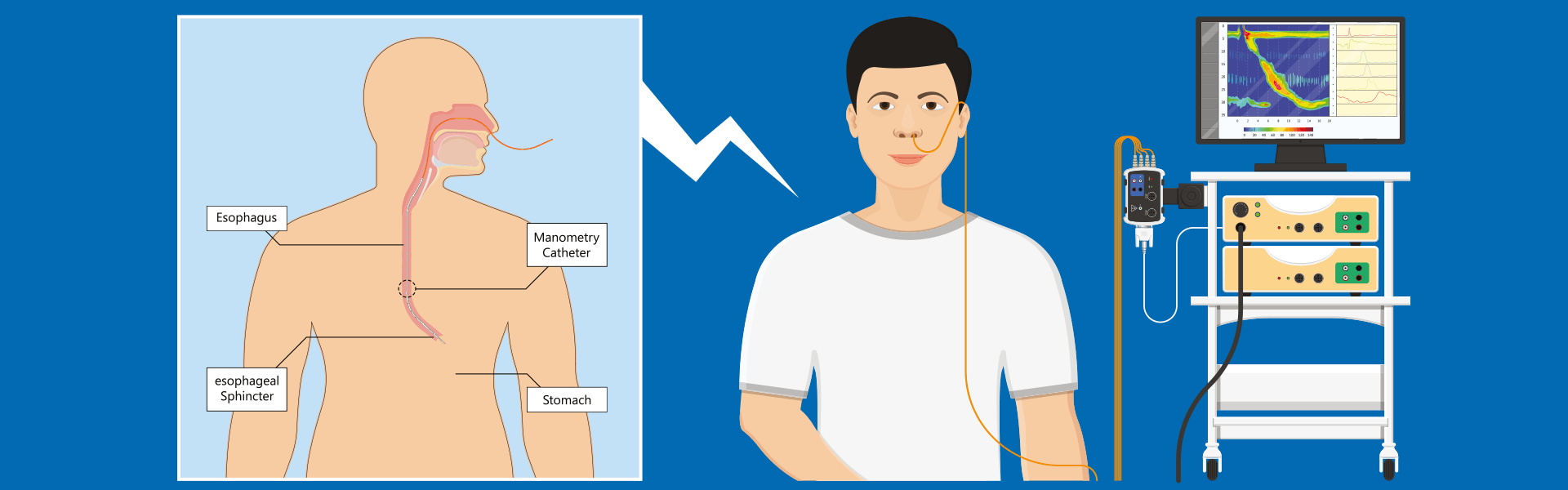 Manometry | Manipal Hospitals India