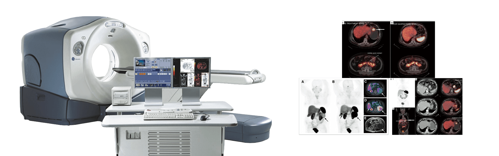 Dotanoc PET CT Scan | Manipal Hospitals India