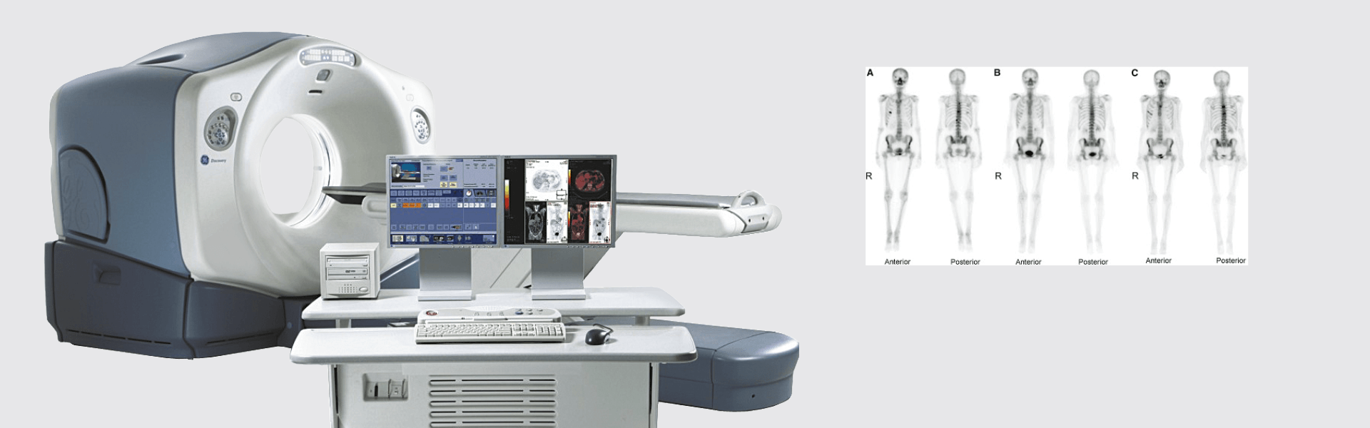 Nuclear PET Scan Centre In Bangalore, India