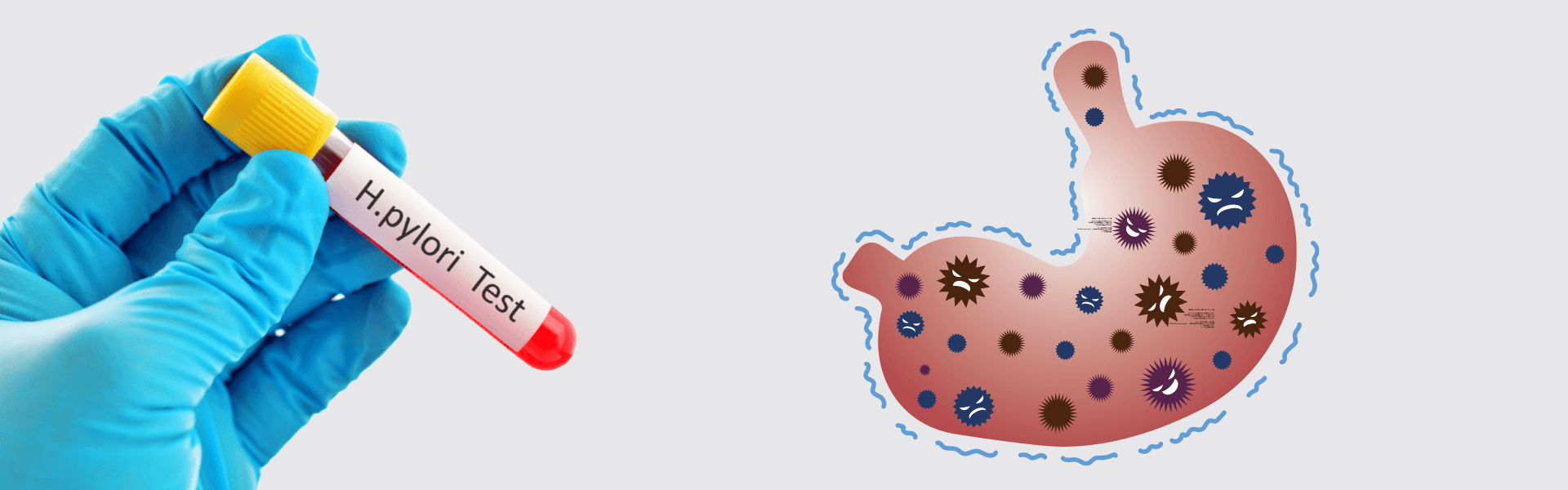 Hydrogen Breath Test | Manipal Hospital India