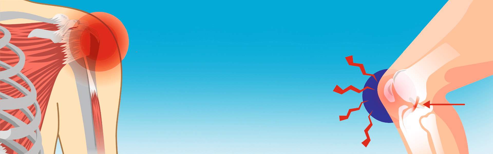 Rheumatology Hospital In Bangalore, India