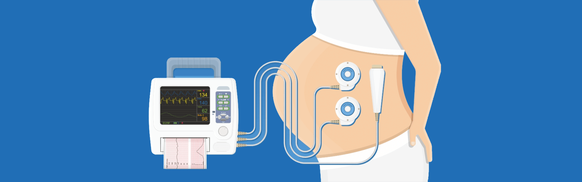 Non - Stress Test | Manipal Hospitals India