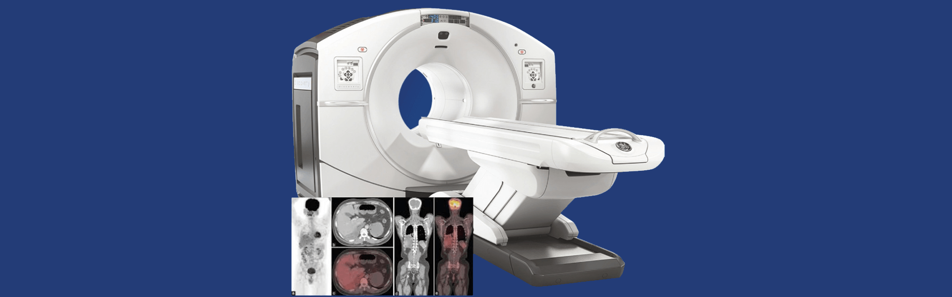 PET Scan Center In Bangalore